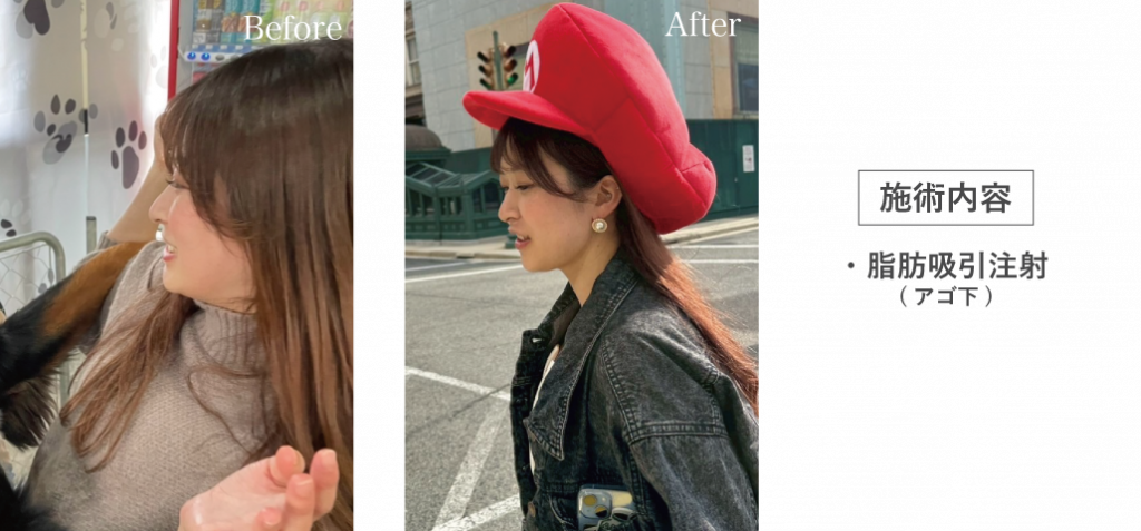 画像に alt 属性が指定されていません。ファイル名: 6-2-1024x477.png