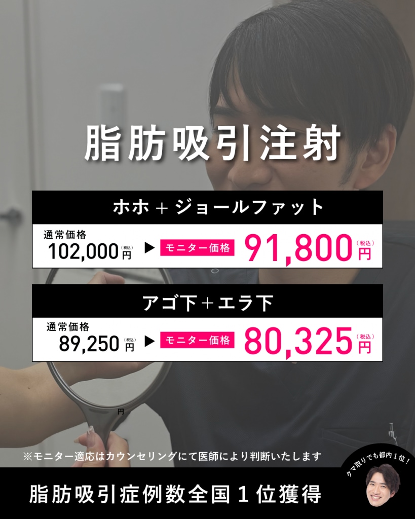 クマ取り料金
