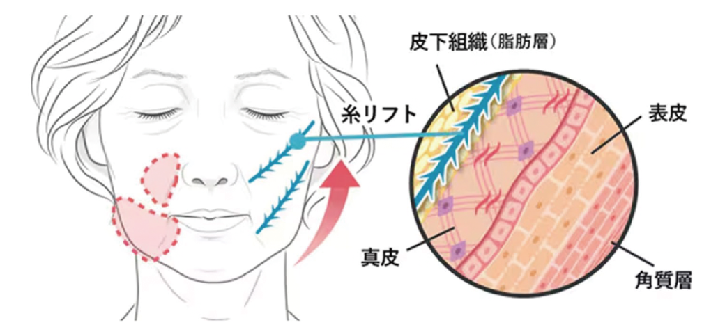 仕組み
