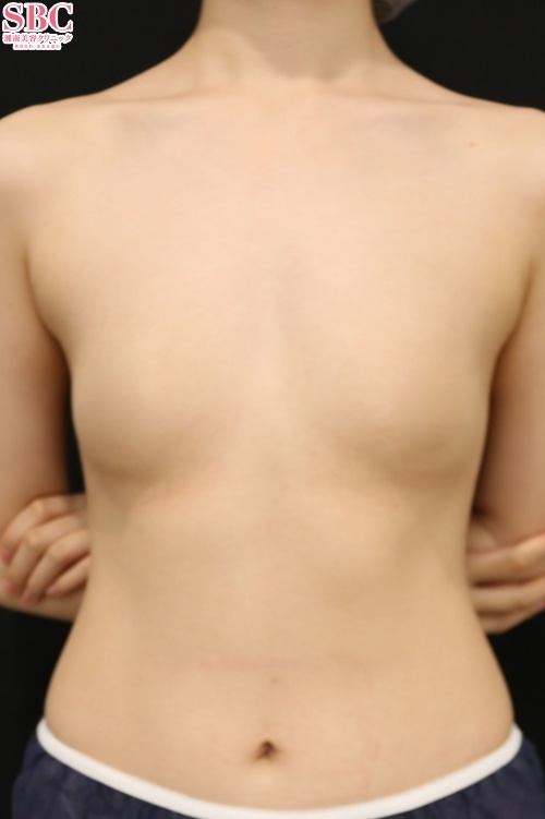 Motivaエルゴノミックス2 症例写真 Before